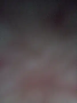 Spider bite online show from February 23, 8:52 pm